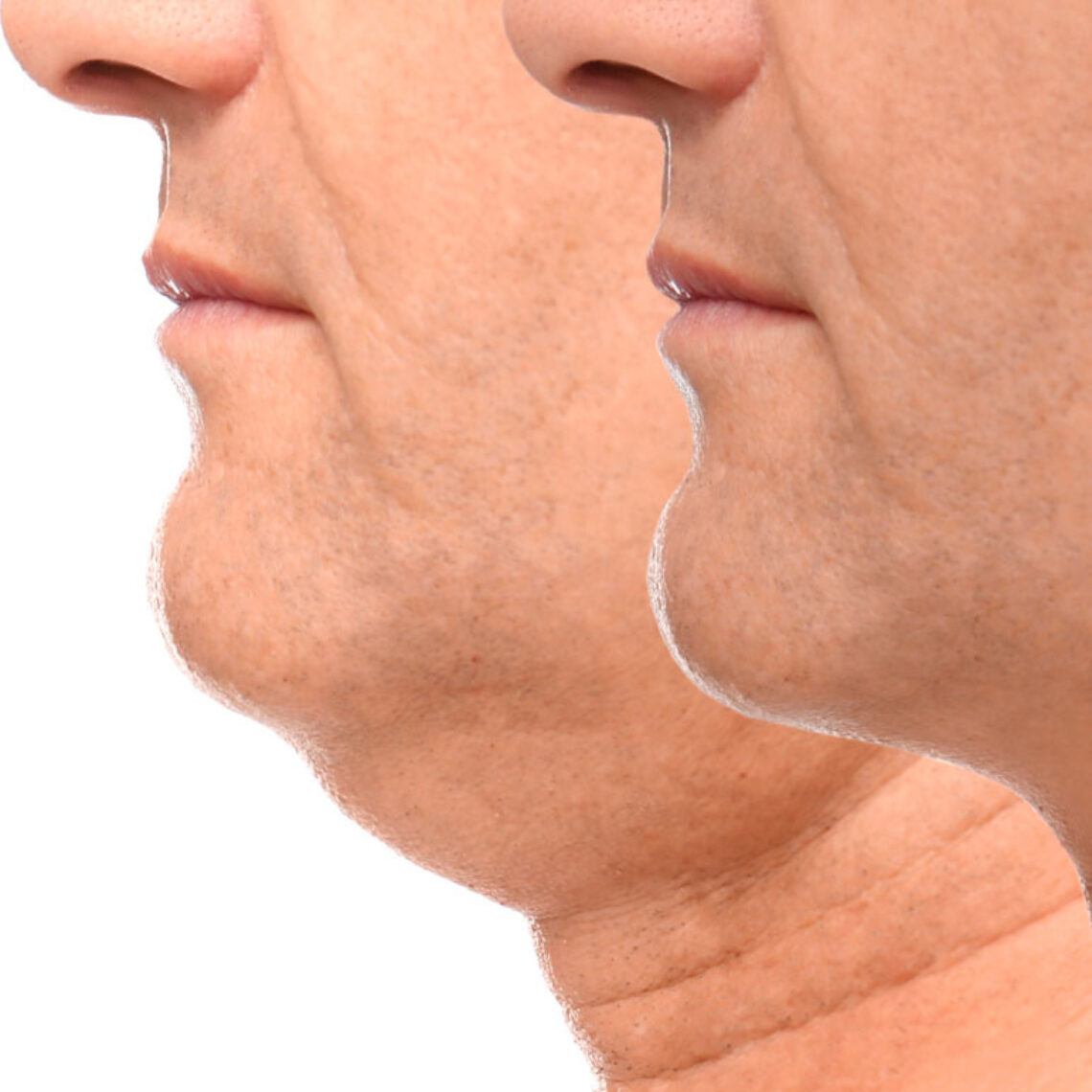 fisioterapia estetica facial valencia