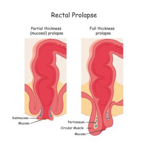 Oh nMTJ3E7bcLPu2d5p3BRLarNeUkktkRnultztCaQrbs4fel6UcNDZDOZDMgMXQ0z1emnWfhKdpMTylzhf3QdAPDOhR3YKomCH0gSg9b0